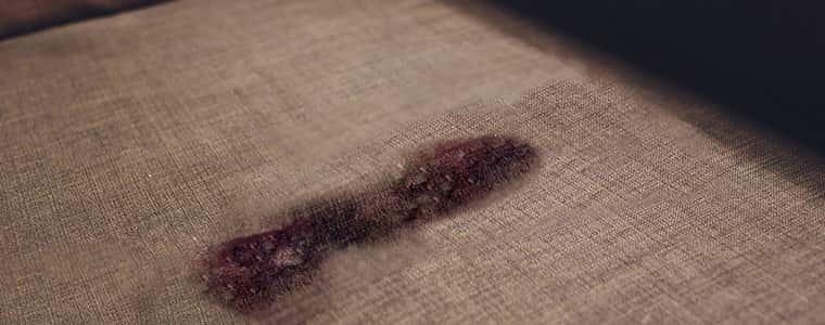 Remove Dry Blood Stains Off The Couch
